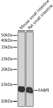 FABPI Rabbit Monoclonal Antibody