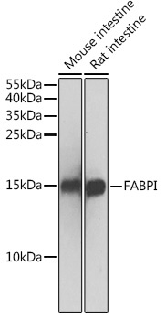FABPI Rabbit Polyclonal Antibody