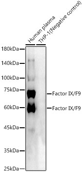 Factor IX / F9 Rabbit Polyclonal Antibody