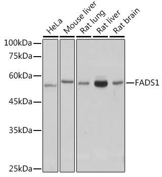 FADS1 Rabbit Monoclonal Antibody
