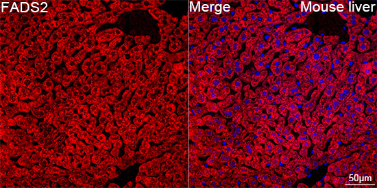 FADS2 Rabbit Polyclonal Antibody - Image 2