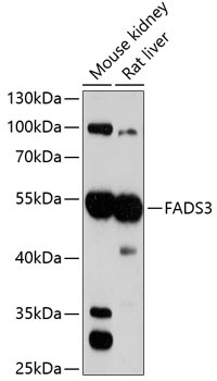 FADS3 Rabbit Polyclonal Antibody