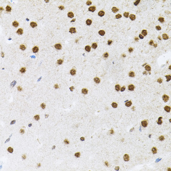 FAF1 Rabbit Polyclonal Antibody - Image 2