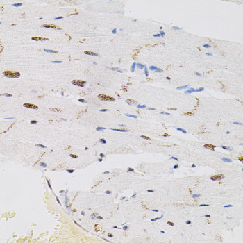 FAF1 Rabbit Polyclonal Antibody - Image 3