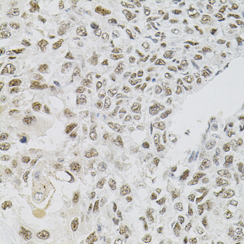 FAF1 Rabbit Polyclonal Antibody - Image 4