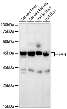 FAH Rabbit Polyclonal Antibody