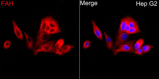 FAH Rabbit Polyclonal Antibody - Image 2