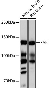 FAK Rabbit Monoclonal Antibody
