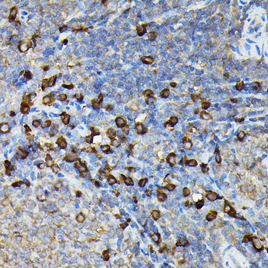 FAM117A Rabbit Polyclonal Antibody - Image 2