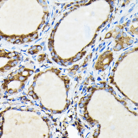FAM117A Rabbit Polyclonal Antibody - Image 3