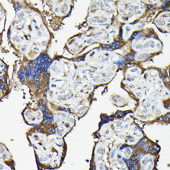 FAM117A Rabbit Polyclonal Antibody - Image 4