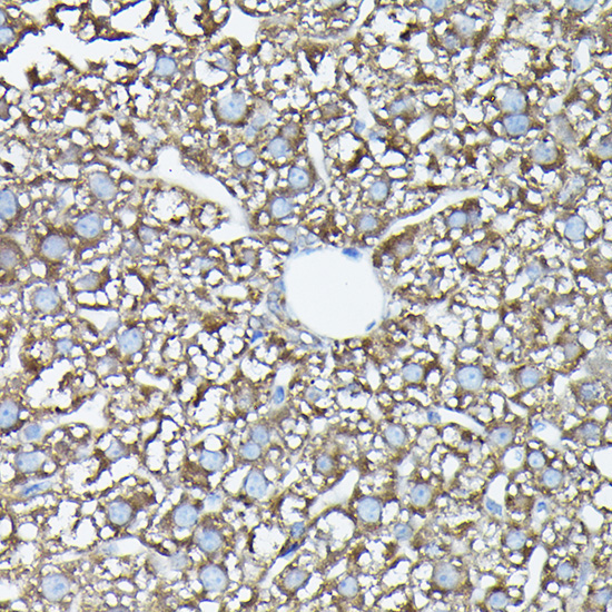 FAM117A Rabbit Polyclonal Antibody - Image 5