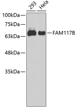 FAM117B Rabbit Polyclonal Antibody