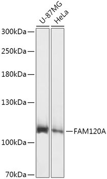 FAM120A Rabbit Polyclonal Antibody