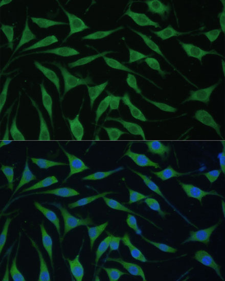 FAM127B Rabbit Polyclonal Antibody - Image 2