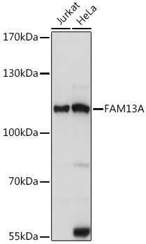 FAM13A Rabbit Polyclonal Antibody