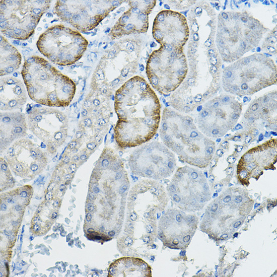 FAM160B2 Rabbit Polyclonal Antibody - Image 2