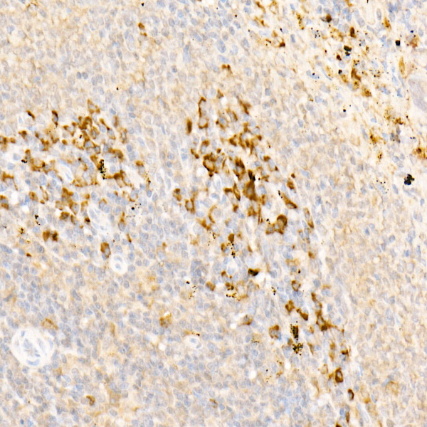 FAM160B2 Rabbit Polyclonal Antibody - Image 3
