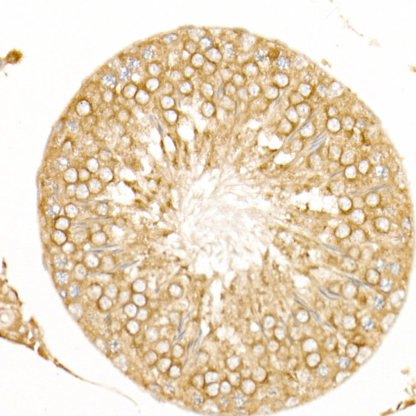 FAM160B2 Rabbit Polyclonal Antibody - Image 4