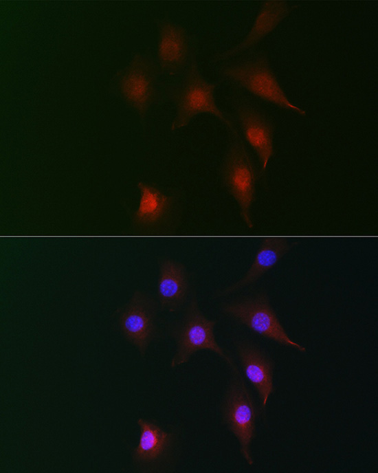 FAM160B2 Rabbit Polyclonal Antibody - Image 5