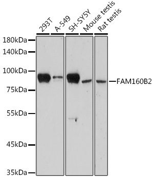 FAM160B2 Rabbit Polyclonal Antibody