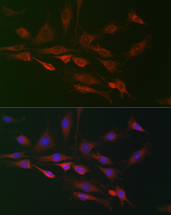 FAM160B2 Rabbit Polyclonal Antibody - Image 2