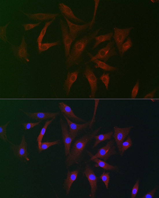 FAM160B2 Rabbit Polyclonal Antibody - Image 3