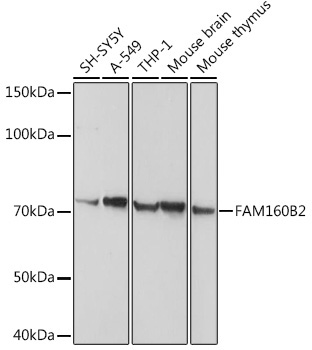 FAM160B2 Rabbit Polyclonal Antibody