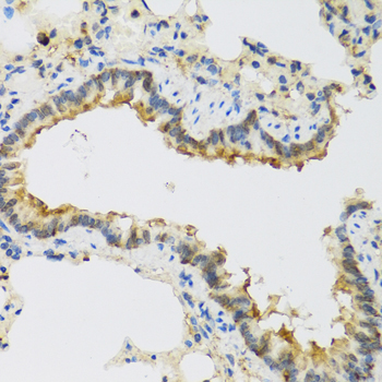 FAM20A Rabbit Polyclonal Antibody - Image 2