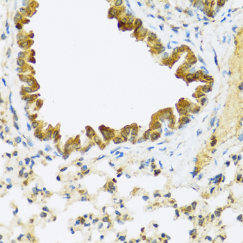 FAM20A Rabbit Polyclonal Antibody - Image 4