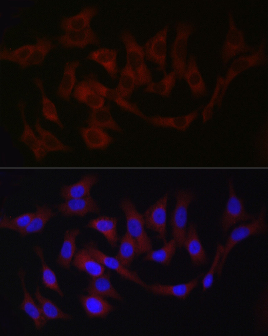 Fam221a Rabbit Polyclonal Antibody - Image 2
