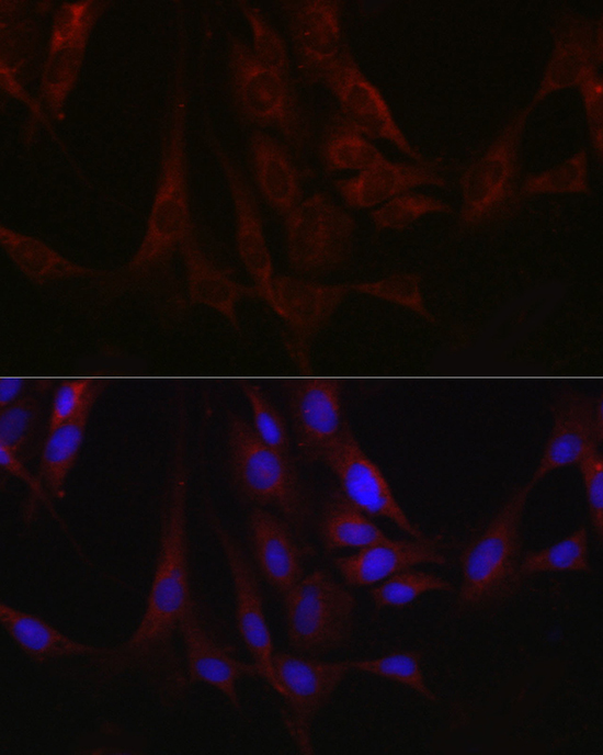 Fam221a Rabbit Polyclonal Antibody - Image 3