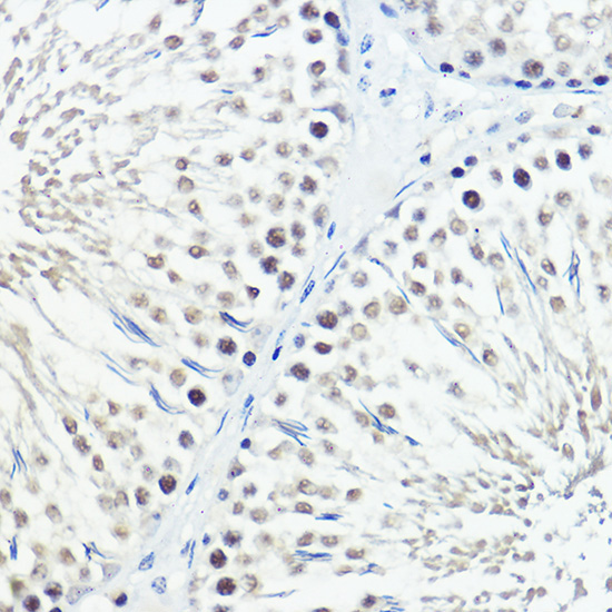Fam221b Rabbit Polyclonal Antibody - Image 2