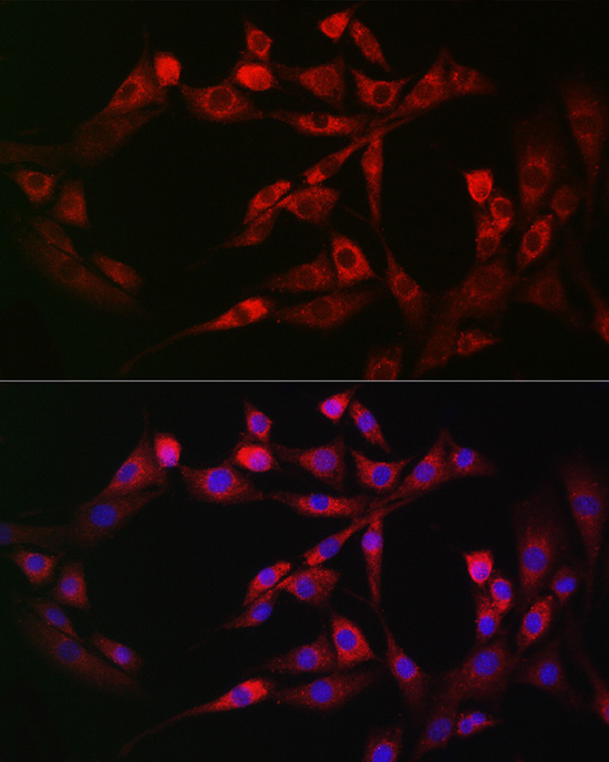 FAM38A/PIEZO1 Rabbit Polyclonal Antibody - Image 2