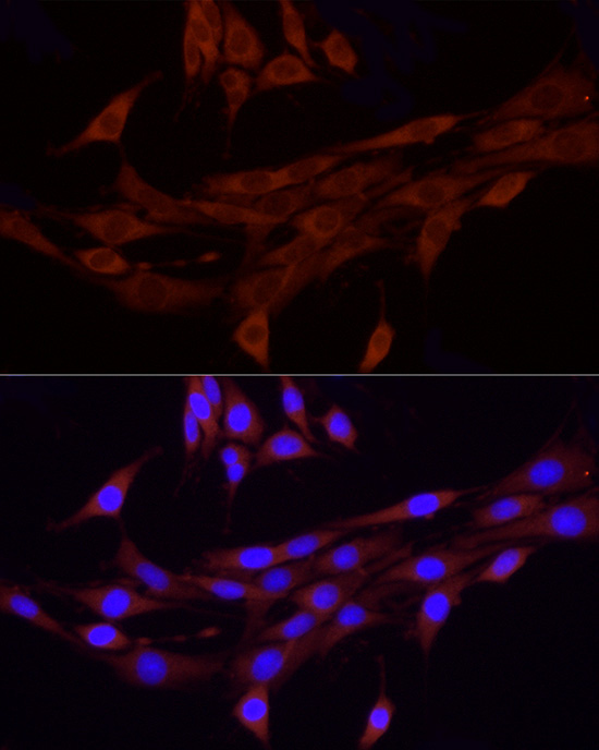 FAM38A/PIEZO1 Rabbit Polyclonal Antibody - Image 3