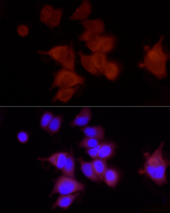 FAM38A/PIEZO1 Rabbit Polyclonal Antibody - Image 4