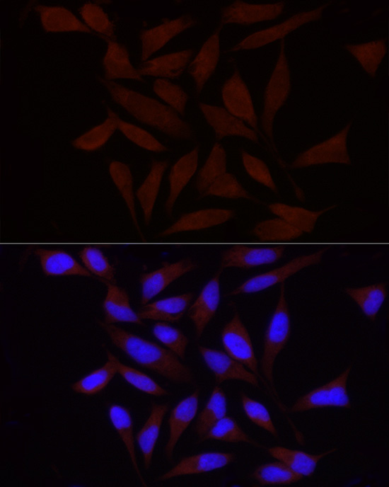 FAM38A/PIEZO1 Rabbit Polyclonal Antibody - Image 5
