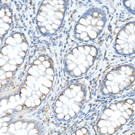FAM3A Rabbit Polyclonal Antibody - Image 2