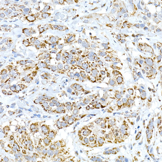 FAM3A Rabbit Polyclonal Antibody - Image 3