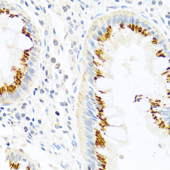FAM3B Rabbit Polyclonal Antibody - Image 2