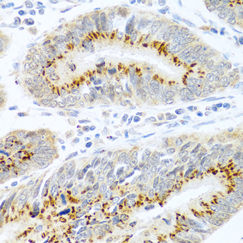 FAM3B Rabbit Polyclonal Antibody - Image 3