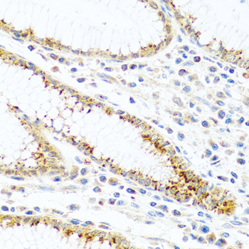 FAM3B Rabbit Polyclonal Antibody - Image 4