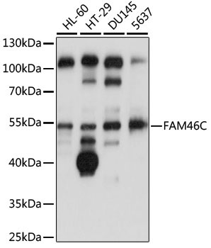 FAM46C Rabbit Polyclonal Antibody
