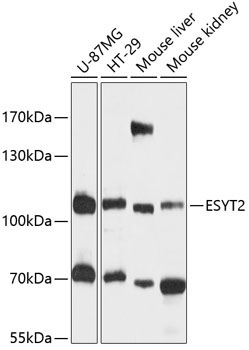 FAM62B Rabbit Polyclonal Antibody