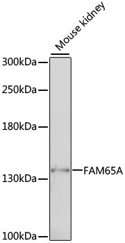 FAM65A Rabbit Polyclonal Antibody