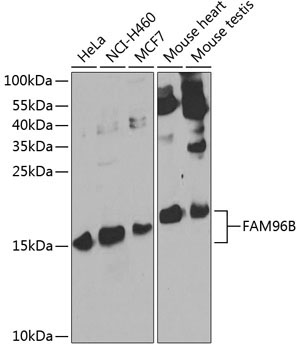 FAM96B Rabbit Polyclonal Antibody