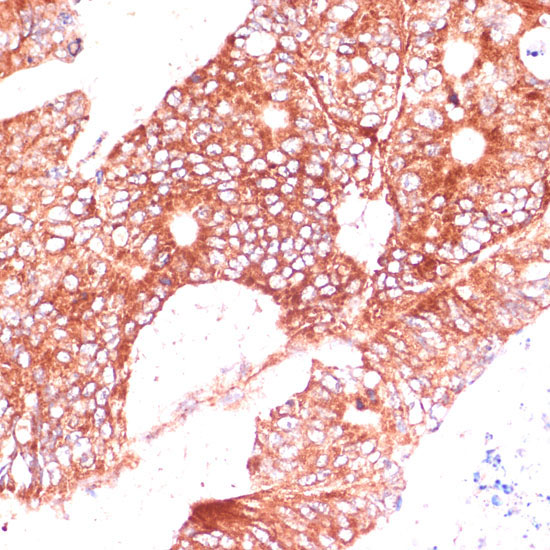 FAM98A Rabbit Polyclonal Antibody - Image 2