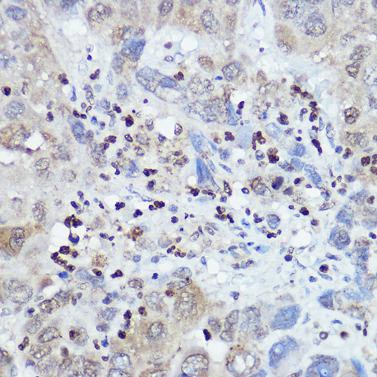 FANCC Rabbit Polyclonal Antibody - Image 2