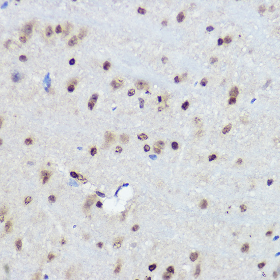 FANCC Rabbit Polyclonal Antibody - Image 3