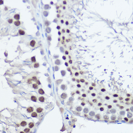 FANCC Rabbit Polyclonal Antibody - Image 4